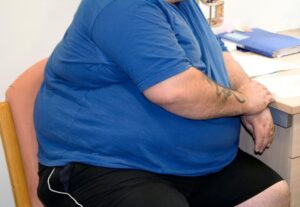 O echipă de cercetători americani susţine că a identificat cauza principală a obezităţii image-2023-04-28-26232973-41-pacient-obezitate