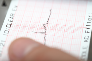 dreamstime_s_35840903