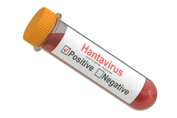 Suspiciune de hantavirus în România: pacientul nu a avut contact cu pasagerii navei de croazieră/depositphotos