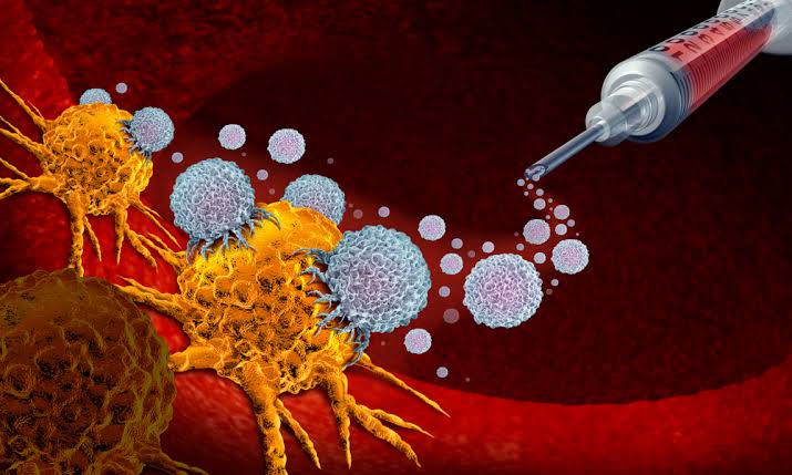 Breakthrough în oncologie: cercetătorii au găsit o metodă de a prezice efectele secundare fatale ale imunoterapiei / depositphotos